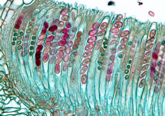 Ascomycetes: An Introduction to the Sac Fungi : Plantlet