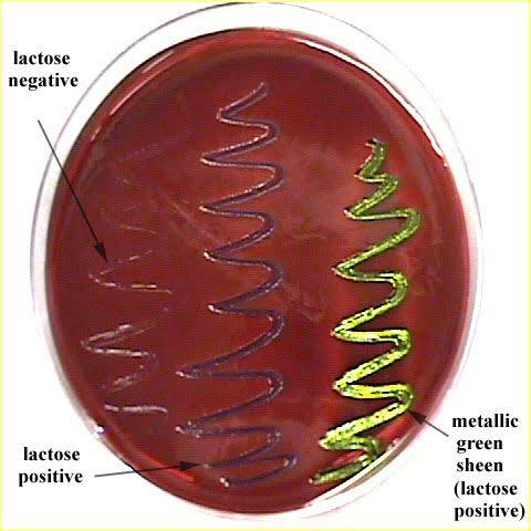 Cultivation of Microorganisms: Types of Culture Medium : Plantlet