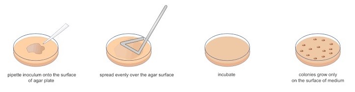 what is the purpose of the spread plate technique