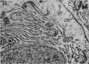 Endoplasmic reticulum in paratoid gland cell.