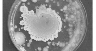 Lactobacilli-colony-isolated-from-sweet-potato-curd-on-MRS-agar-medium