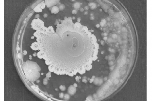 Lactobacilli-colony-isolated-from-sweet-potato-curd-on-MRS-agar-medium